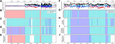 Classification of Cassini’s Orbit Regions as Magnetosphere, Magnetosheath, and Solar Wind via Machine Learning